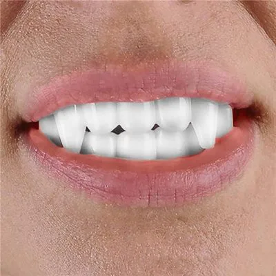 Vampire Fangs — Bulk Party Pack