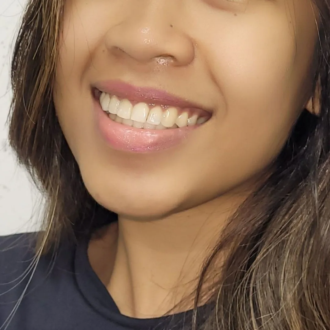 Warm, natural-light portrait of a Filipino woman in her 30s, mid-laugh, genuine and unposed, in a bright clinic interior with soft beige walls and a potted plant in the background. Framed by two concentric thin gold rings — the signature motif — with a soft tan-to-ivory gradient fill behind her. A small circular badge overlaps the bottom-left edge of the ring frame. Not a stock smile. Not a handshake. Not a team photo.